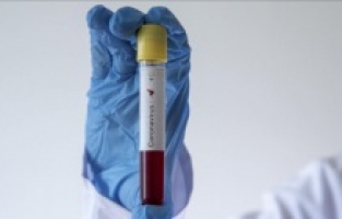 Bosna Hersek’e girişte PCR testi zorunluluğu devam edecek